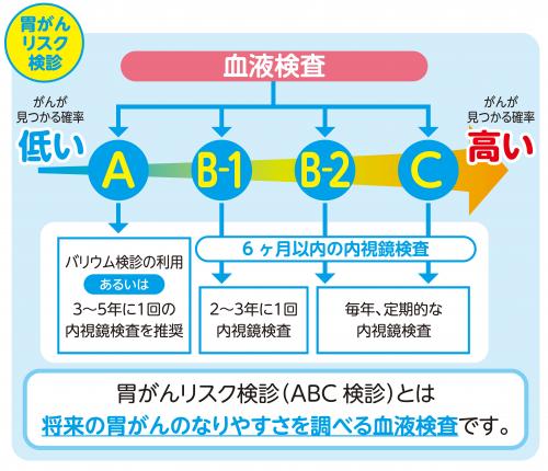 胃がんリスク(ABC)検診イメージ