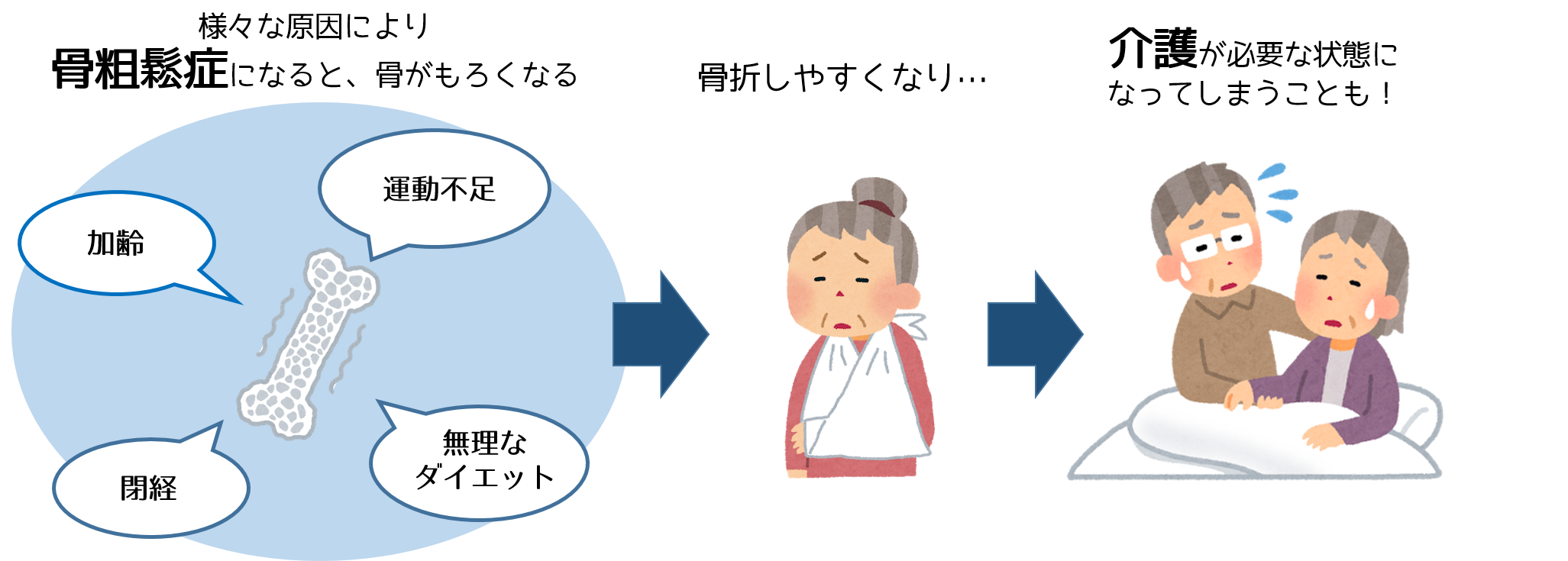 骨粗鬆症の原因