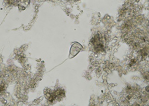 浄化センターの微生物２